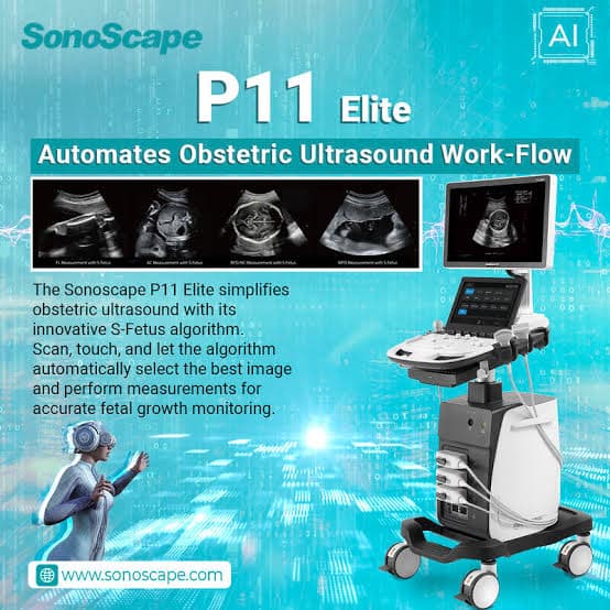 SonoScape P11 Elite